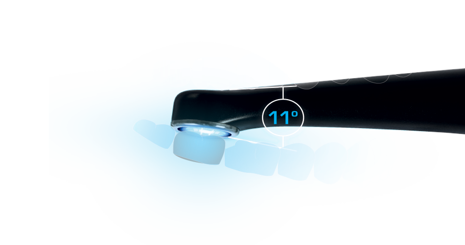 Jaw outline with VALO easily accessing back molars